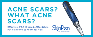 SkinPen for scars